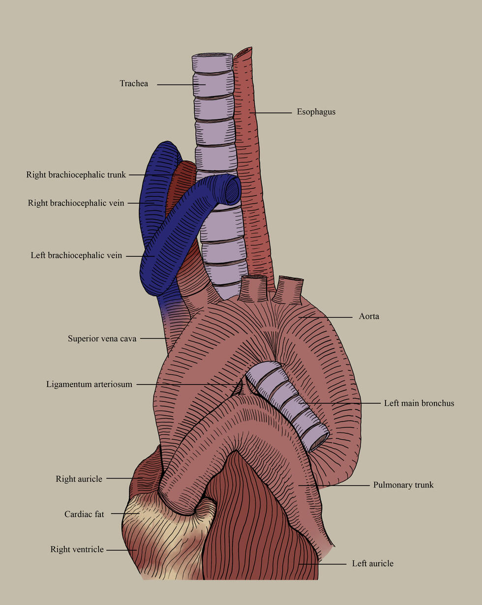 Left lateral view of Aortic arch branches displaying relationship with Trachea and Esophagus